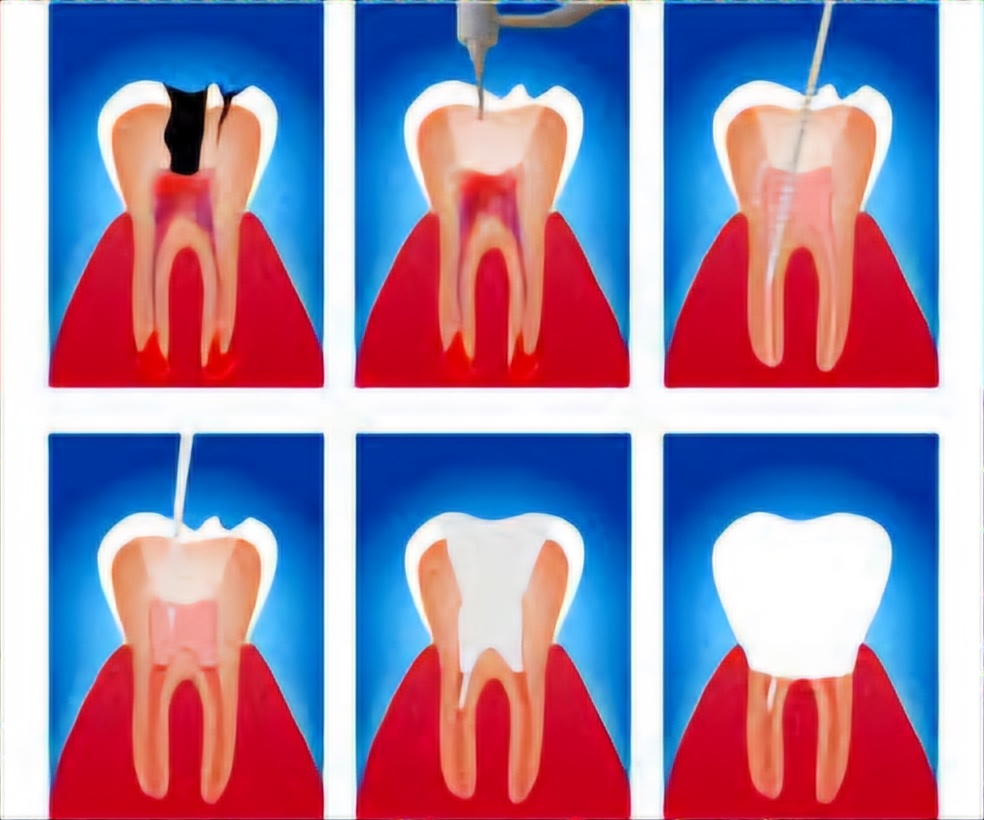 عکس دندان -درمانگاه دندانپزشکی آپادانا