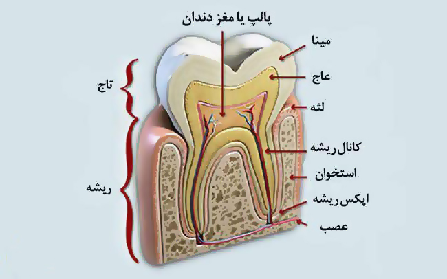 پالپوتومی دندان-کلینیک دندانپزشکی آپادانا رشت